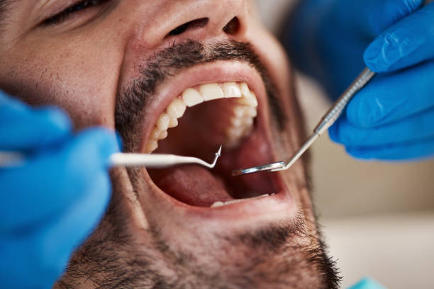 Best Emergency Cosmetic Dentistry (e.g., broken veneers) in Goodrich, MI
