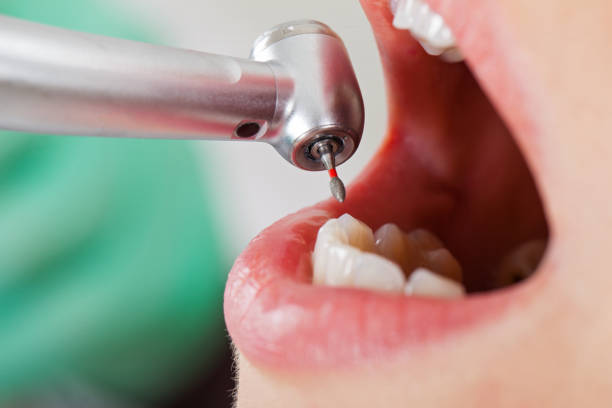 Best Emergency Care for Gum Disease in Goodrich, MI